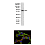 Anti-FGG: Mouse Fibrinogen-gamma Antibody