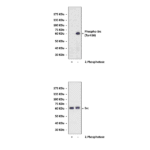 Anti-Phospho-Src: Polyclonal Src, Phospho-Tyr416 Antibody