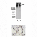 Anti-Ki-67: Mouse Ki-67 Antibody