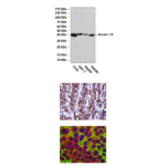 Anti-Keratin 19: Mouse Keratin 19 Antibody