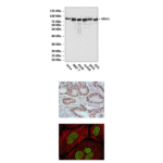 Anti-MLH1: Mouse MutL Homolog 1 Antibody