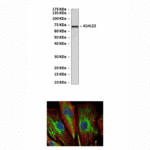 Anti-KLHL22: Mouse KLHL22 Antibody