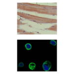 Anti-MuSK: Mouse Muscle Specific Kinase Antibody