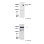 Anti-Phospho-SRC-3/AIB-1: Polyclonal Steroid Receptor Coactivator-3, Phospho-Thr24 Antibody