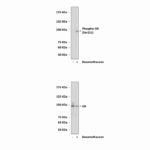 Anti-Phospho-GR: Polyclonal Glucocorticoid Receptor, Phospho-Ser211 Antibody