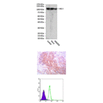 Anti-HK II: Mouse Hexokinase II Antibody