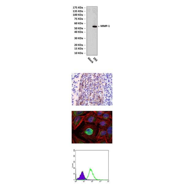 Anti-MMP-1: Mouse MMP-1 Antibody