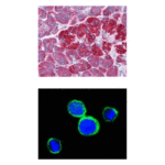 Anti-REG1A: Mouse REG1A Antibody