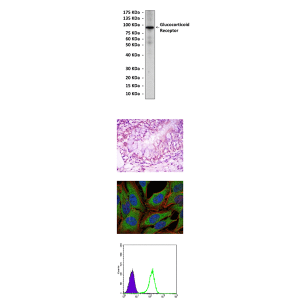 Anti-Glucocorticoid Receptor: Mouse Glucocorticoid Receptor Antibody