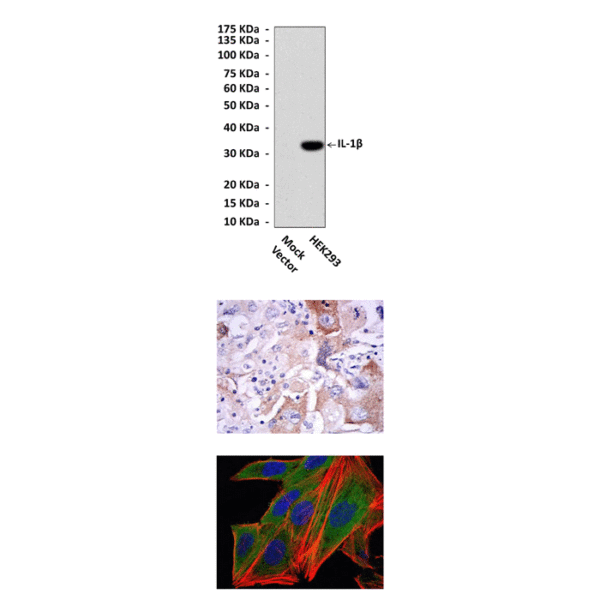 Anti-IL-1β: Mouse IL-1beta Antibody
