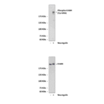 Anti-Phospho-ErbB4: Polyclonal ErbB4, Phospho-Tyr1056 Antibody