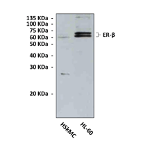 Anti-ER-β: Polyclonal Estrogen Receptor-beta Antibody