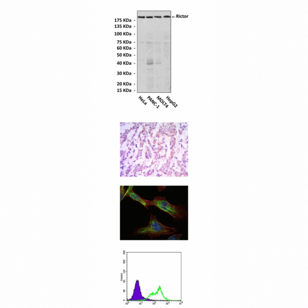 Anti-Rictor: Mouse Rictor Antibody