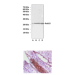 Anti-Rab25: Mouse Ras-Associated Binding factor 25 Antibody