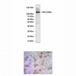 Anti-IRE1/ERN1: Mouse IRE1/ERN1 Antibody