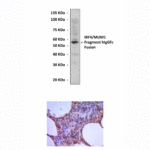 Anti-IRF4/MUM1: Mouse IRF4/MUM1 Antibody