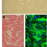 Human Aortic Smooth Muscle Cells: HAOSMC