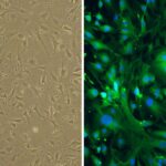 Human Astrocytes: HA