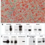 Human Preadipocytes: S-HPAd: Pre-Screened