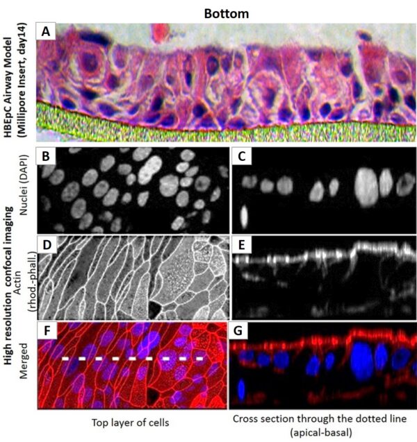 Human Bronchial Epithelial Cells:  HBEpC