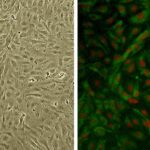 Human Brachiocephalic Artery Endothelial Cells: HBcAEC