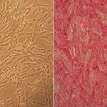Human Brachiocephalic Artery Smooth Muscle Cells: HBcASMC