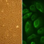 Human Bladder Epithelial Cells: HBlEpC