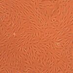 Human Chondrocytes: Rheumatoid Arthritis: HC-RA