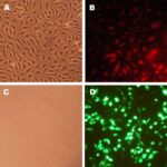 Human Coronary Artery Endothelial Cells: Plaque: HCAEC-q