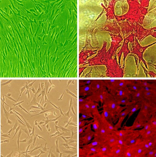 Human Coronary Artery Smooth Muscle Cells:  HCASMC