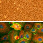 Human Corneal Epithelial Cells: HCEpC