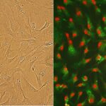 Human Cardiac Fibroblasts: HCF