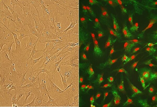 Human Cardiac Fibroblasts: HCF