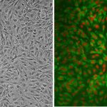Human Carotid Artery Endothelial Cells:  HCtAEC