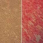 Human Carotid Artery Smooth Muscle Cells: HCtASMC