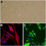 Human Dermal Fibroblasts: HDF