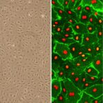 Human Dermal Lymphatic Microvascular Endothelial Cells: HDLMVEC