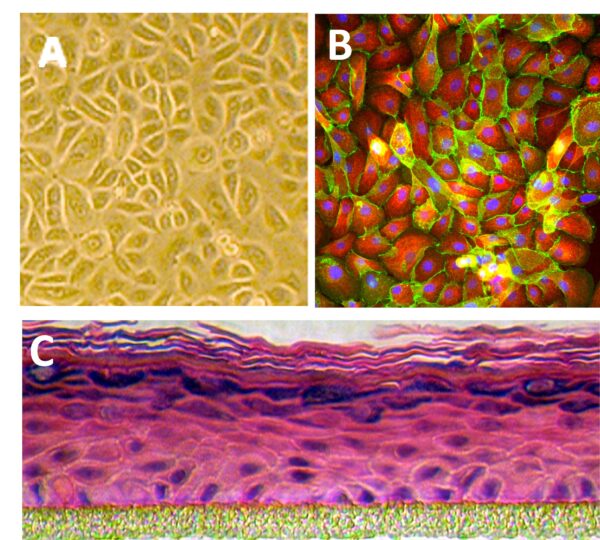 Human Epidermal Keratinocytes: HEK