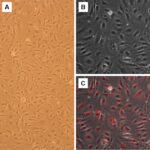 Human Femoral Artery Endothelial Cells: HFAEC