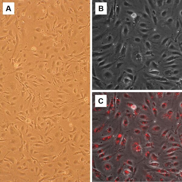 Human Femoral Artery Endothelial Cells: HFAEC