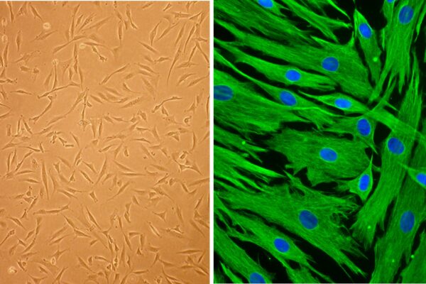 Human Hair Follicle Dermal Papilla Cells: HFDPC