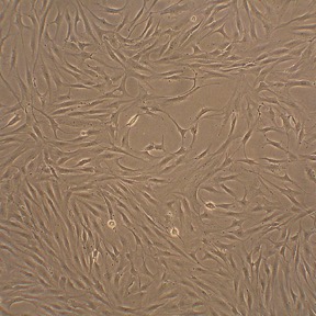 Human Fibroblast-Like Synoviocytes: HFLS