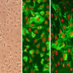 Human Internal Thoracic Artery Endothelial Cells: HITAEC