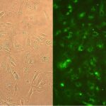 Human Lung Fibroblasts: HLF