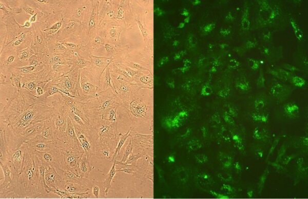 Human Lung Fibroblasts: HLF