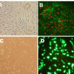 Human Lung Microvascular Endothelial Cells:  HLMVEC