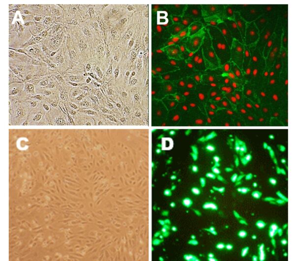 Human Lung Microvascular Endothelial Cells: Type 2 Diabetes: HLMVEC-T2D