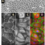 Human Mammary Epithelial Cells: HMEpC