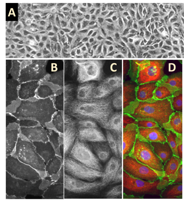 Human Mammary Epithelial Cells: HMEpC