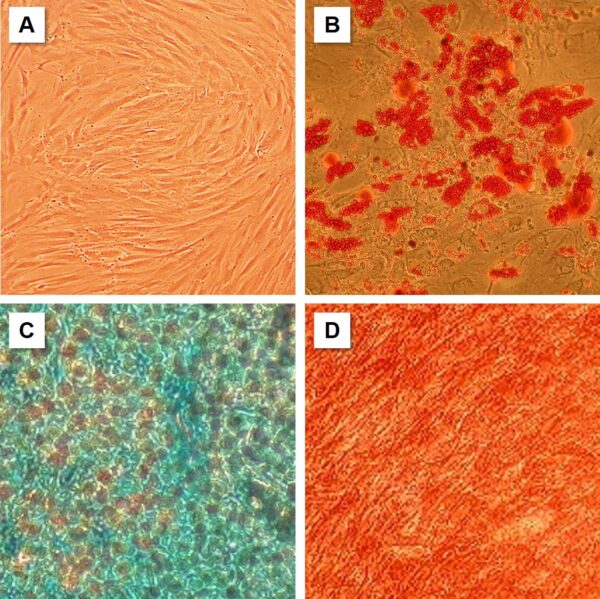 Human Mesenchymal Stem Cells: HMSC